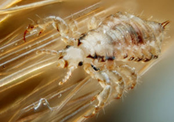 head lice removal in childen